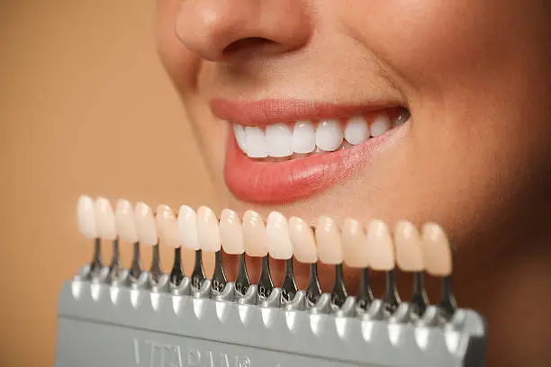 Sorriso perfetto con trattamenti di estetica dentale — Studio Dentistico Dr. Bedini